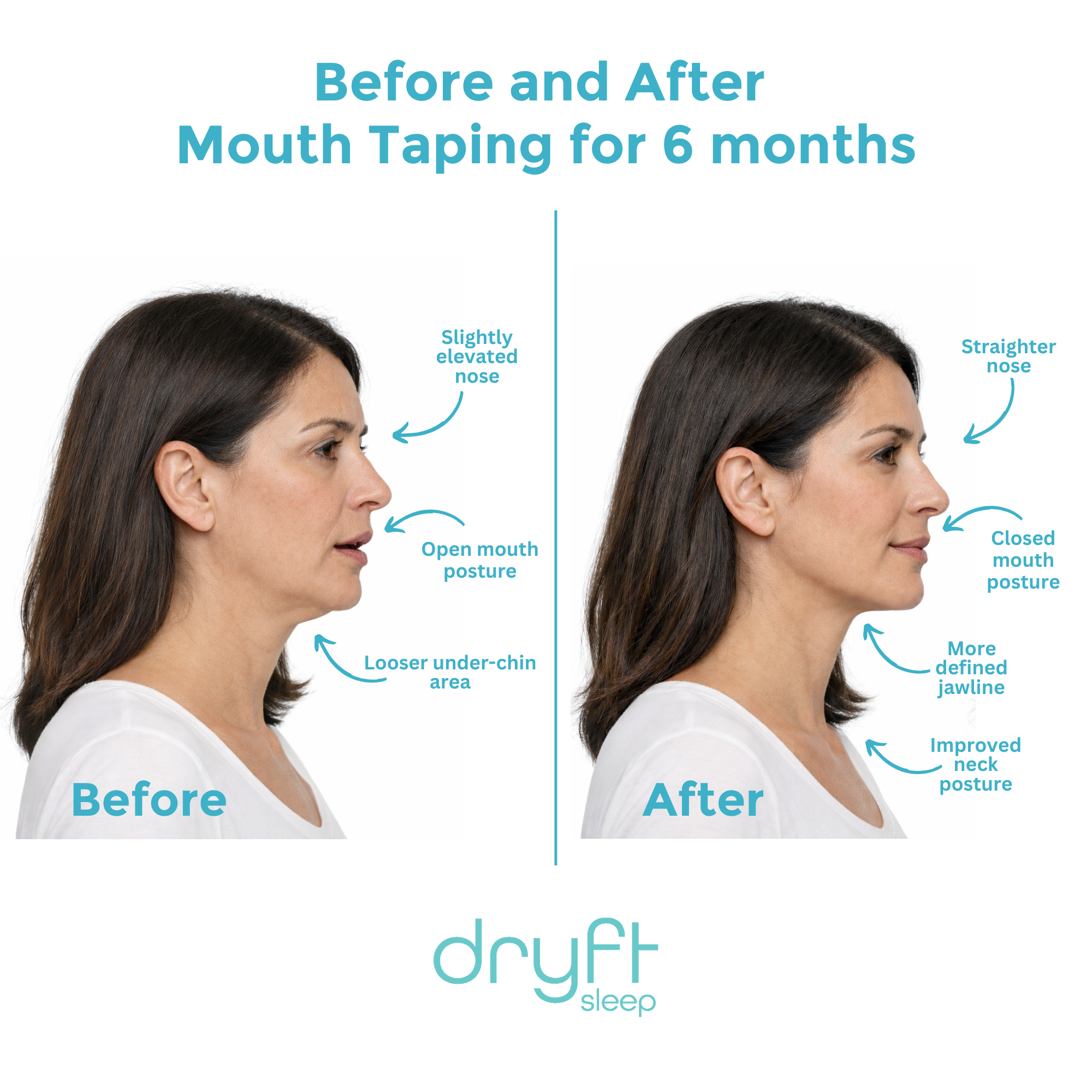Dryft Sleep Mouth Tape