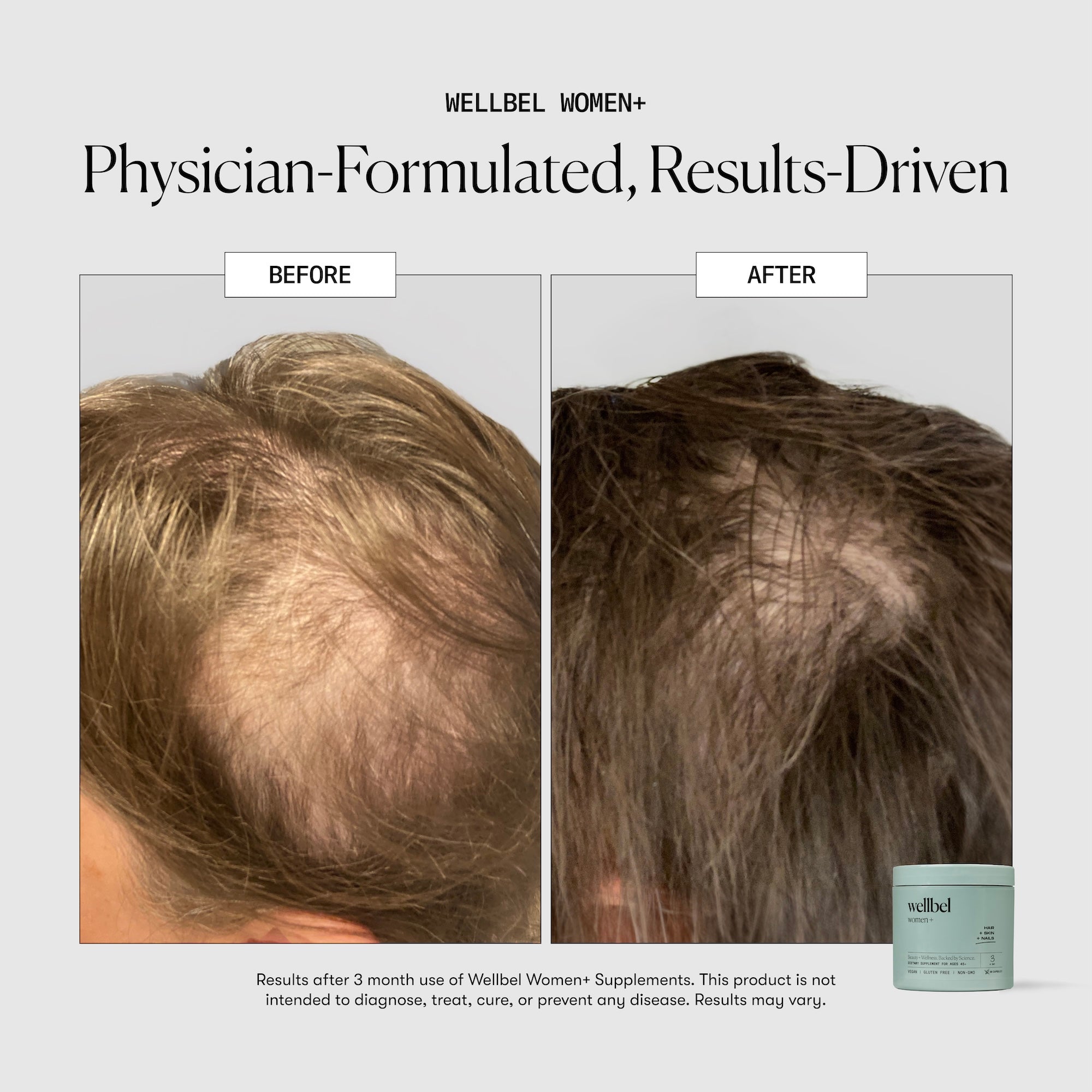 Wellbel Women+ Bundle