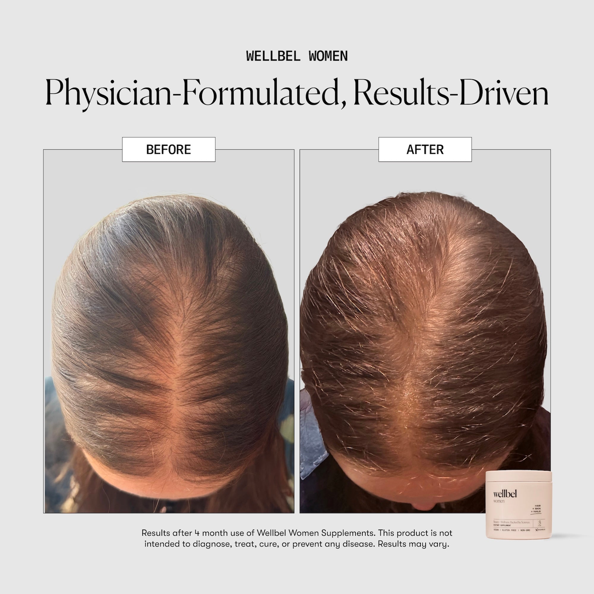 Wellbel Women Bundle