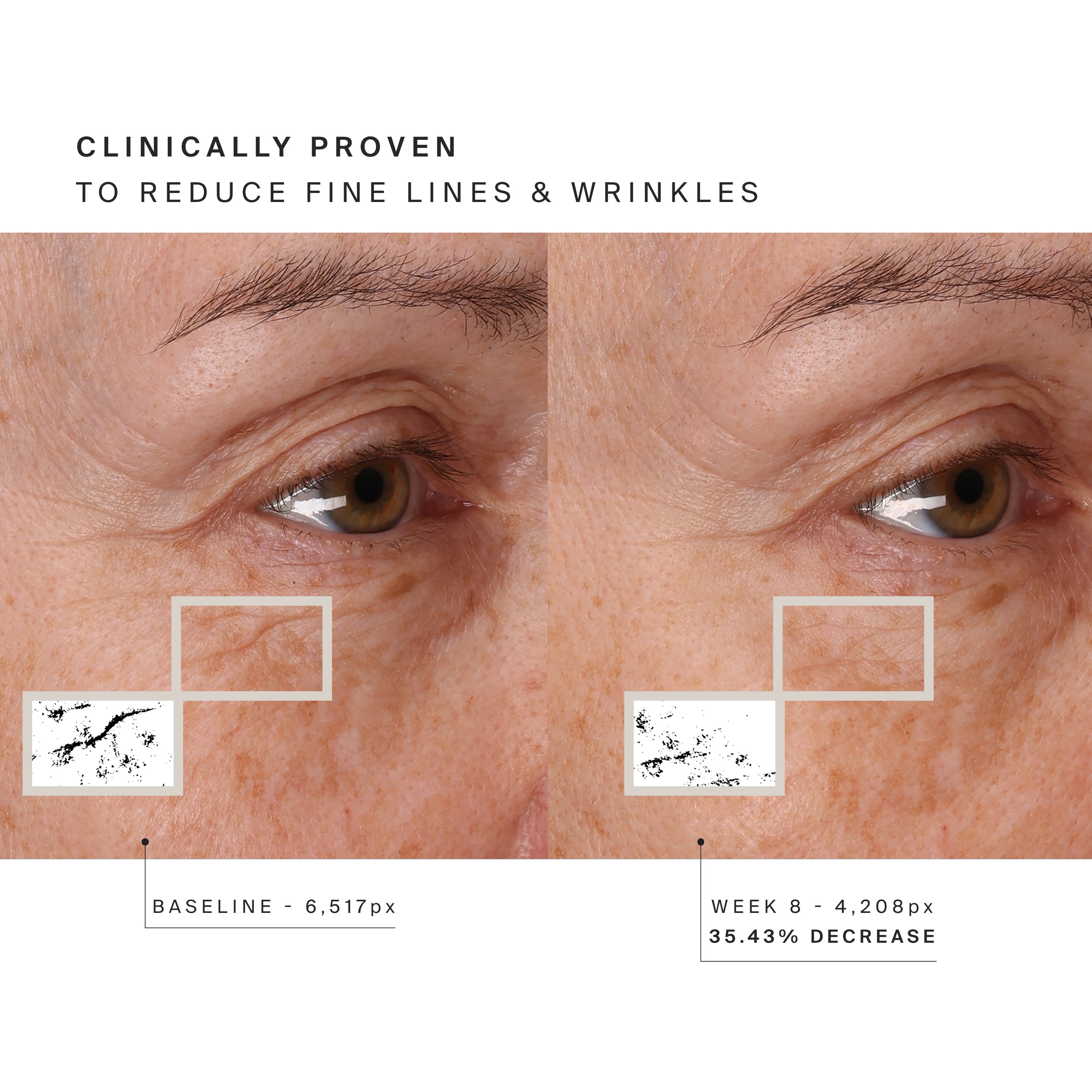 Higherdose Red Light Face Mask