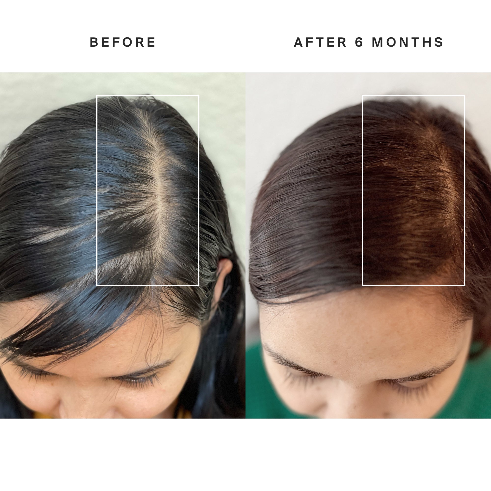 Higherdose Red Light Hat